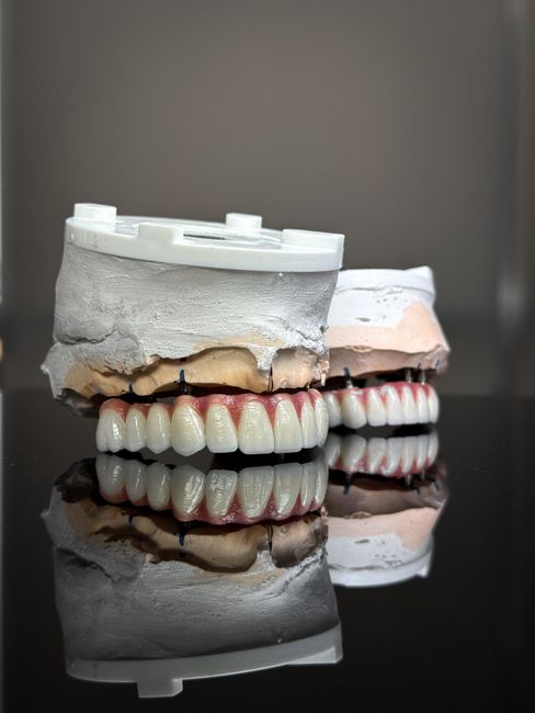 Full Mouth Reconstruction